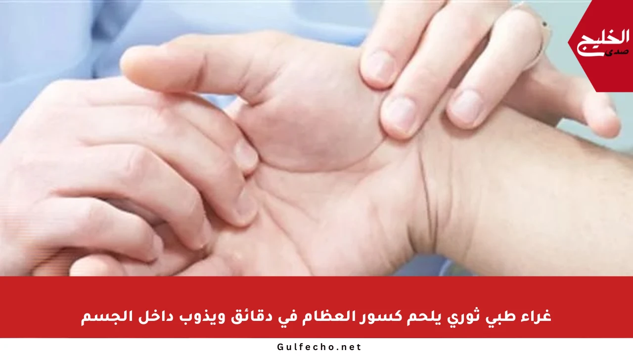 غراء طبي ثوري يلحم كسور العظام في دقائق ويذوب داخل الجسم